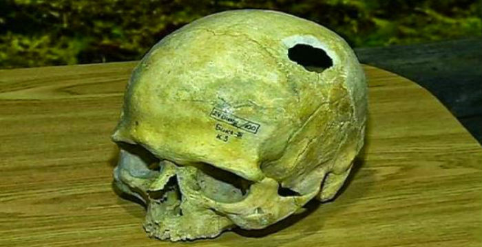 siviria-ippokratis-stin-archeotita